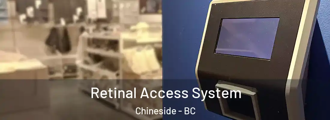  Retinal Access System Chineside - BC
